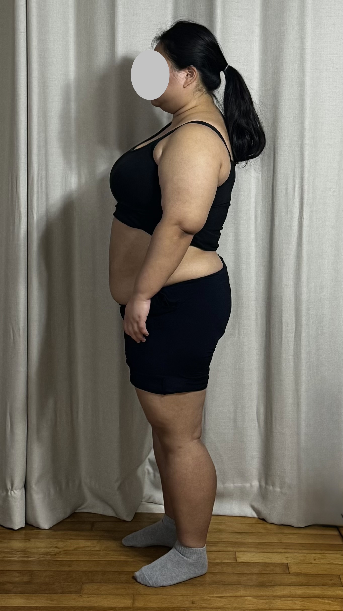 천안점 치료 전
