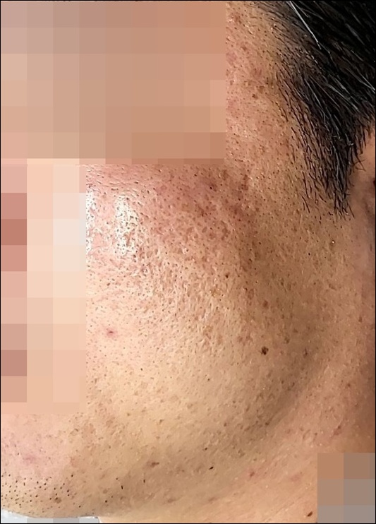 전후사진