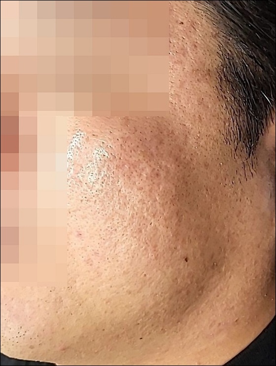 전후사진