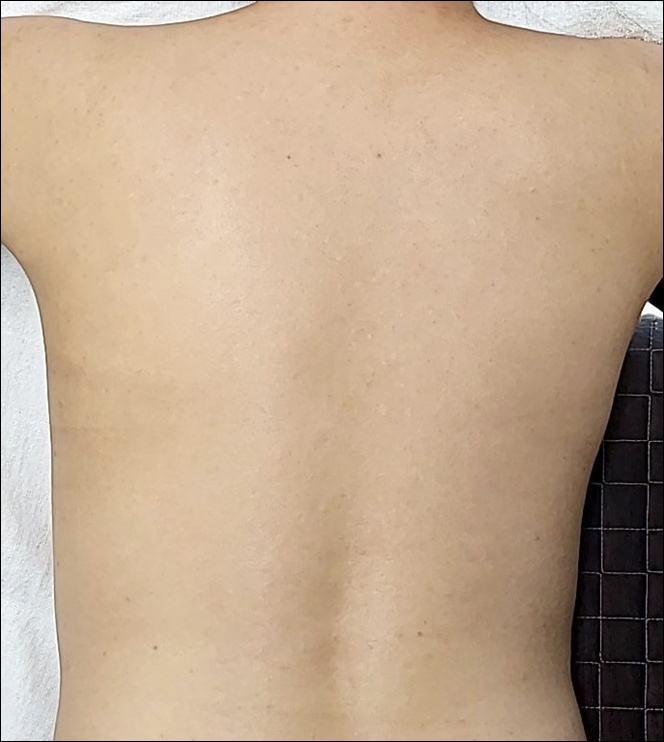 광주점 치료 후