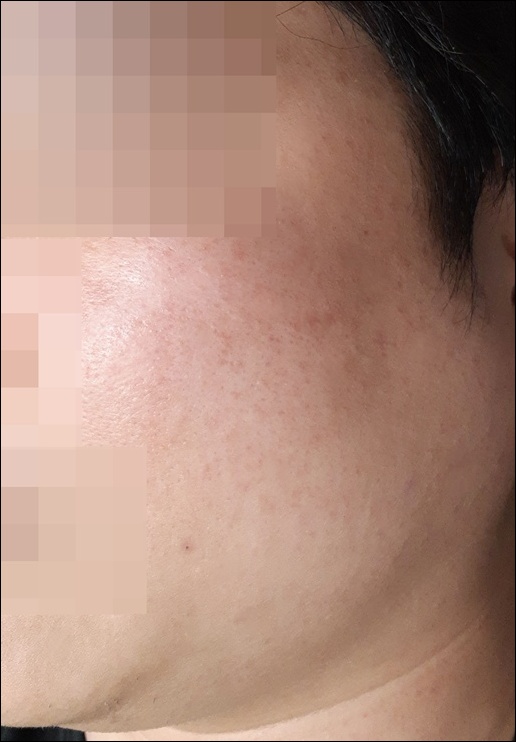 전후사진