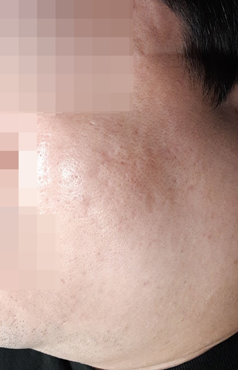 전후사진
