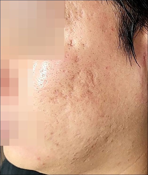 광주점 치료 전