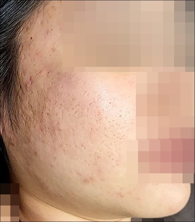 전후사진