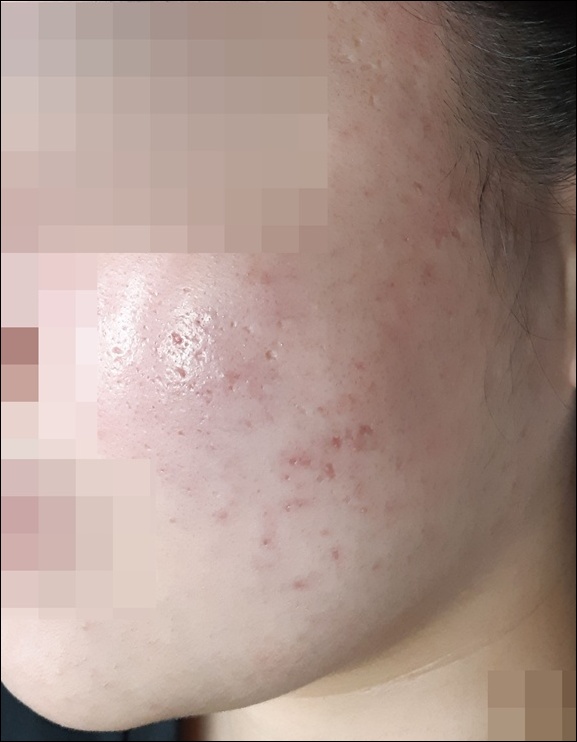 전후사진