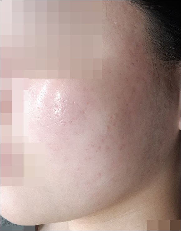 전후사진