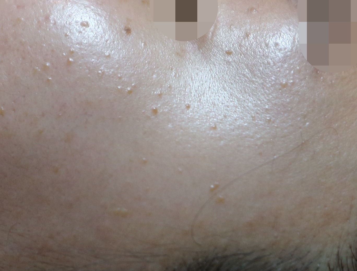 전후사진