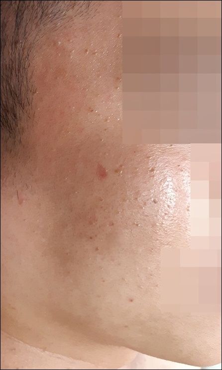 전후사진