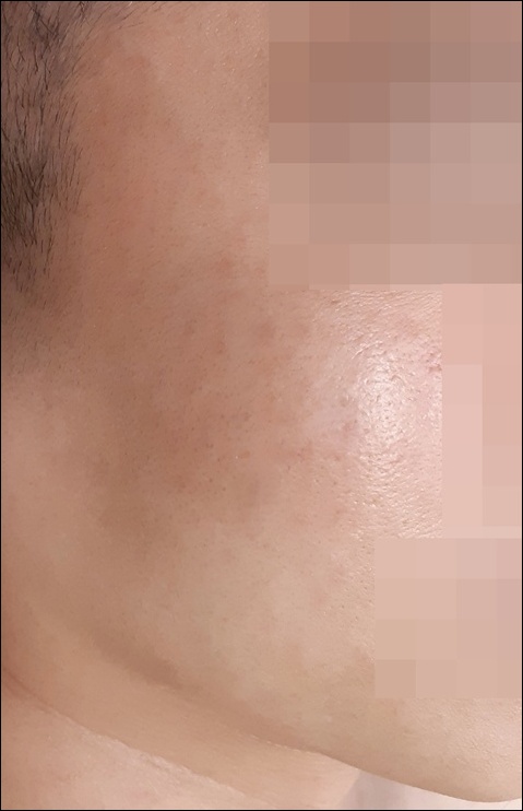 전후사진