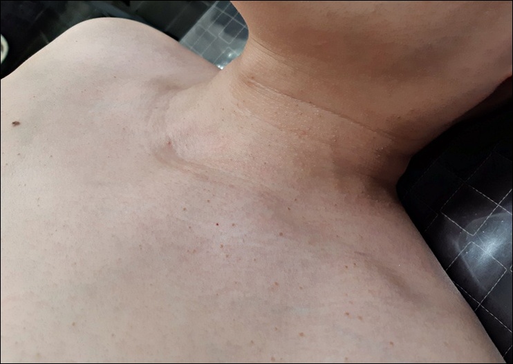 전후사진