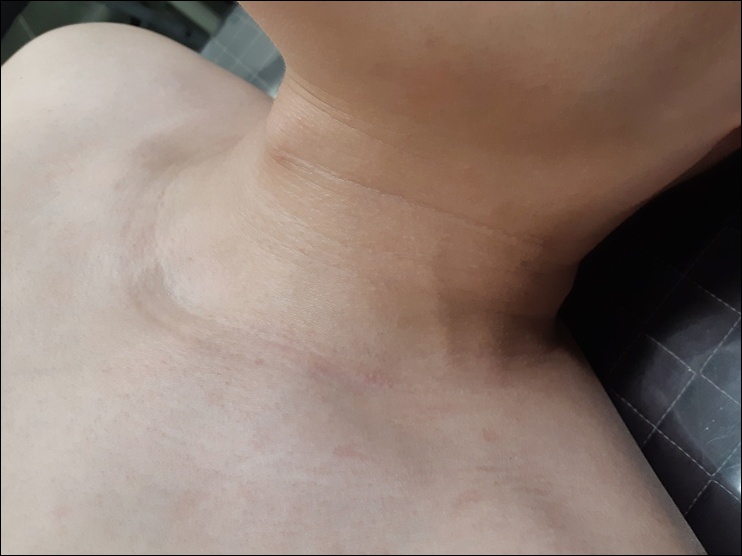 전후사진