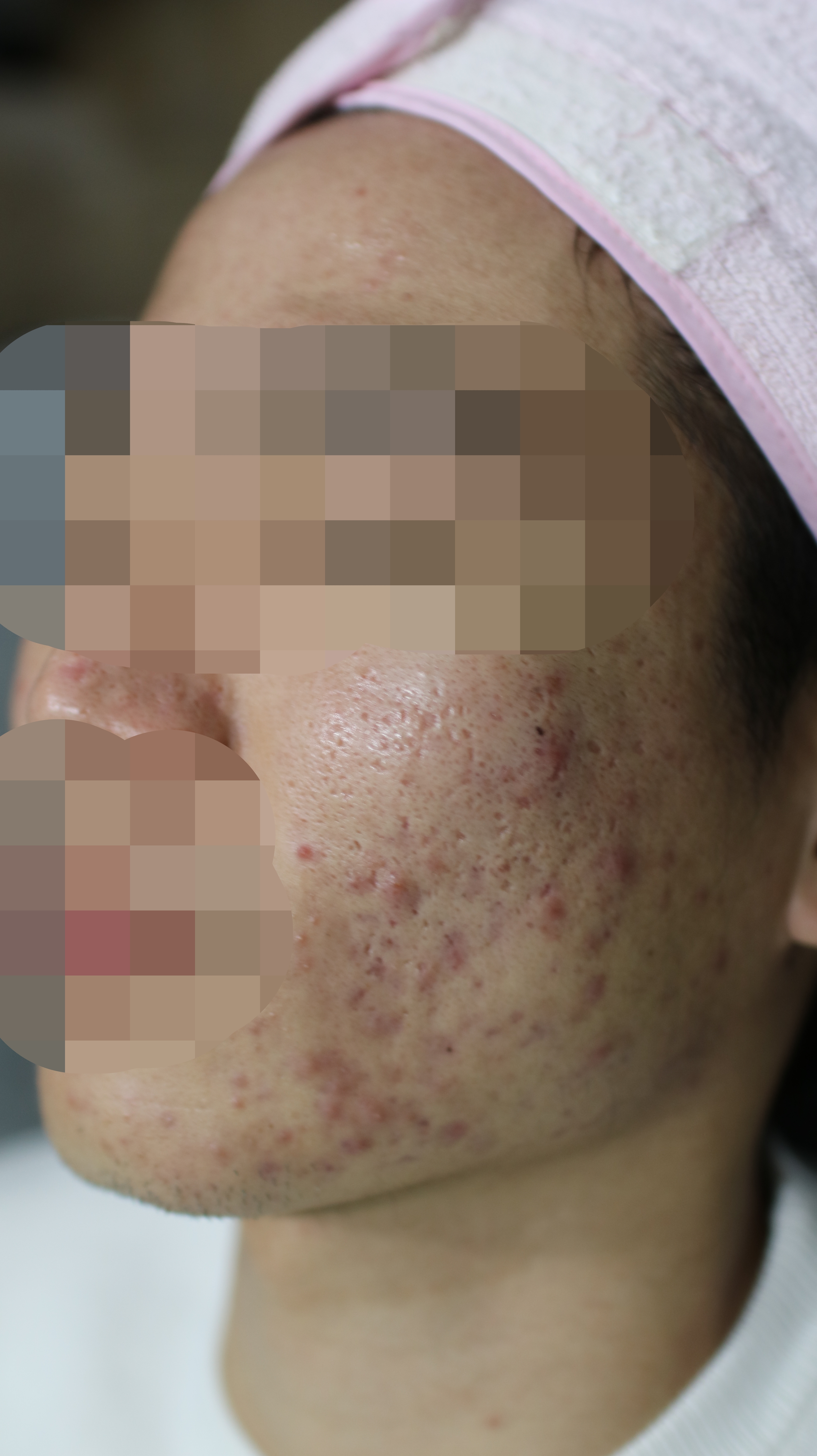 전후사진