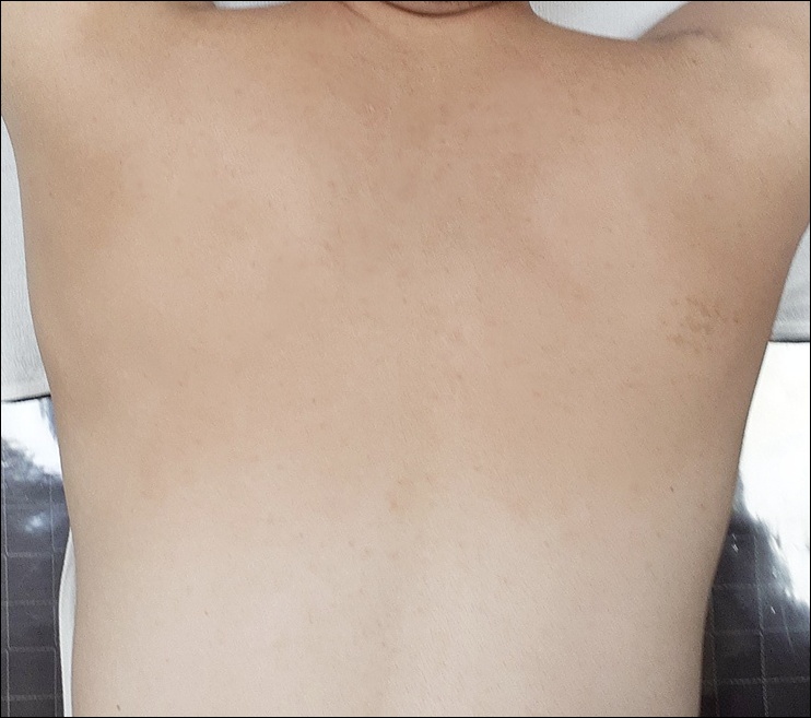 전후사진