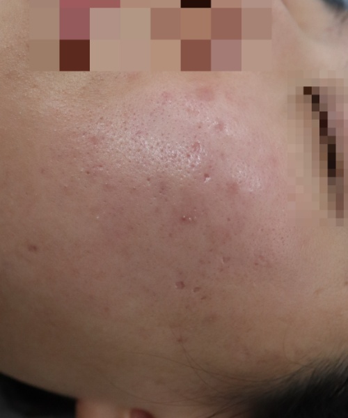 전후사진
