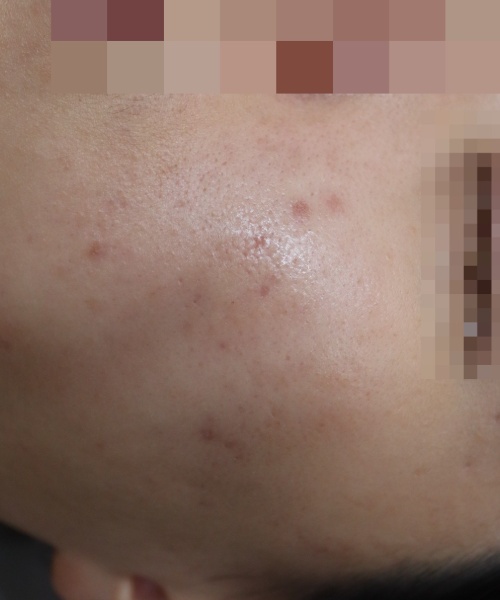 전후사진