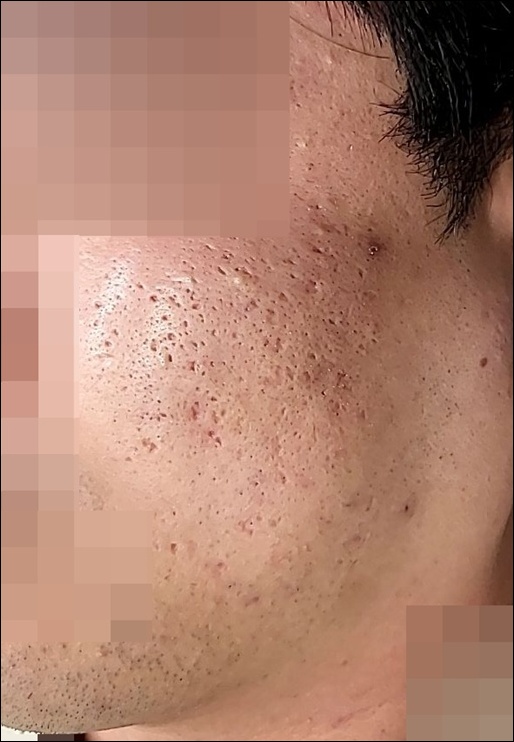 전후사진