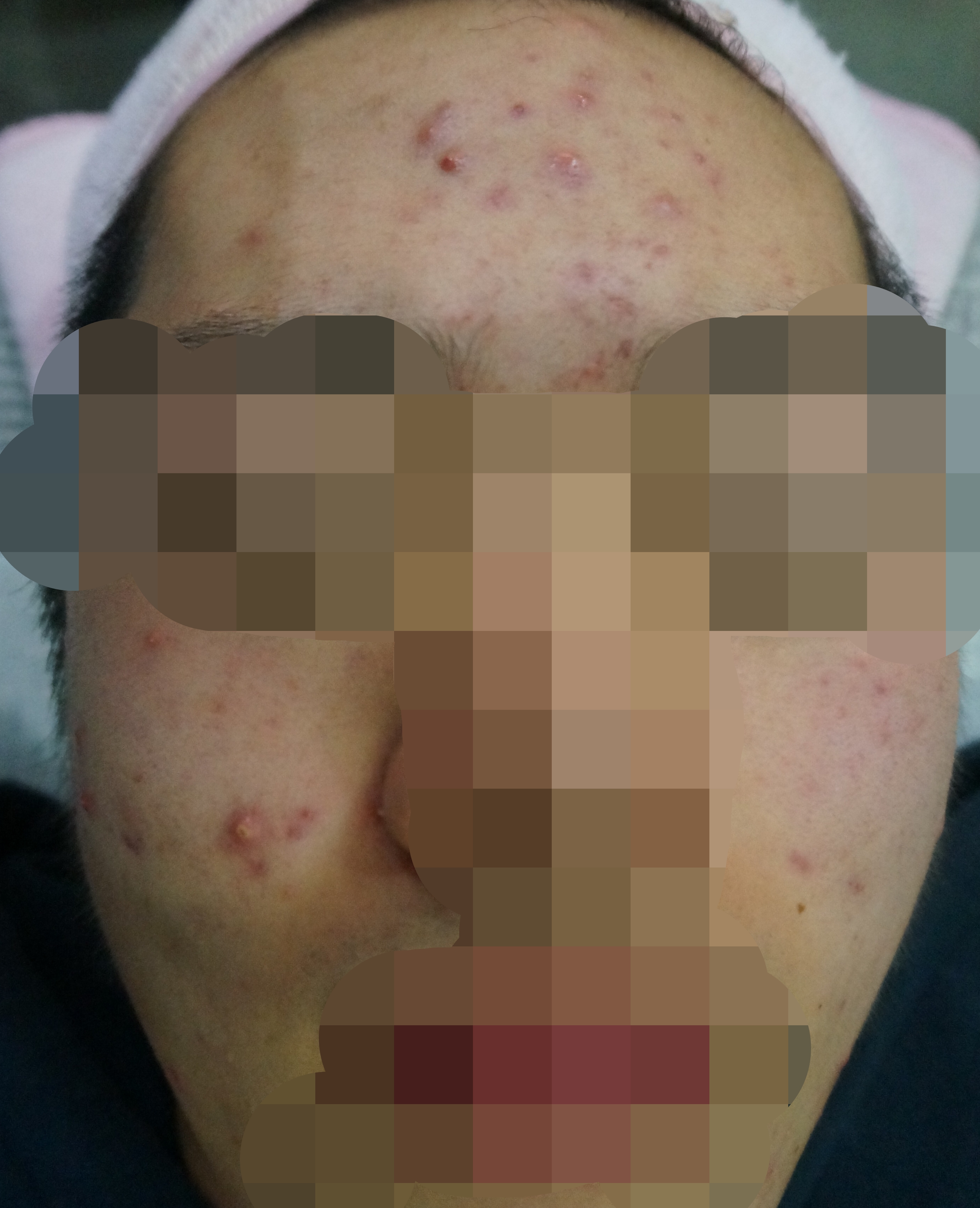 전후사진