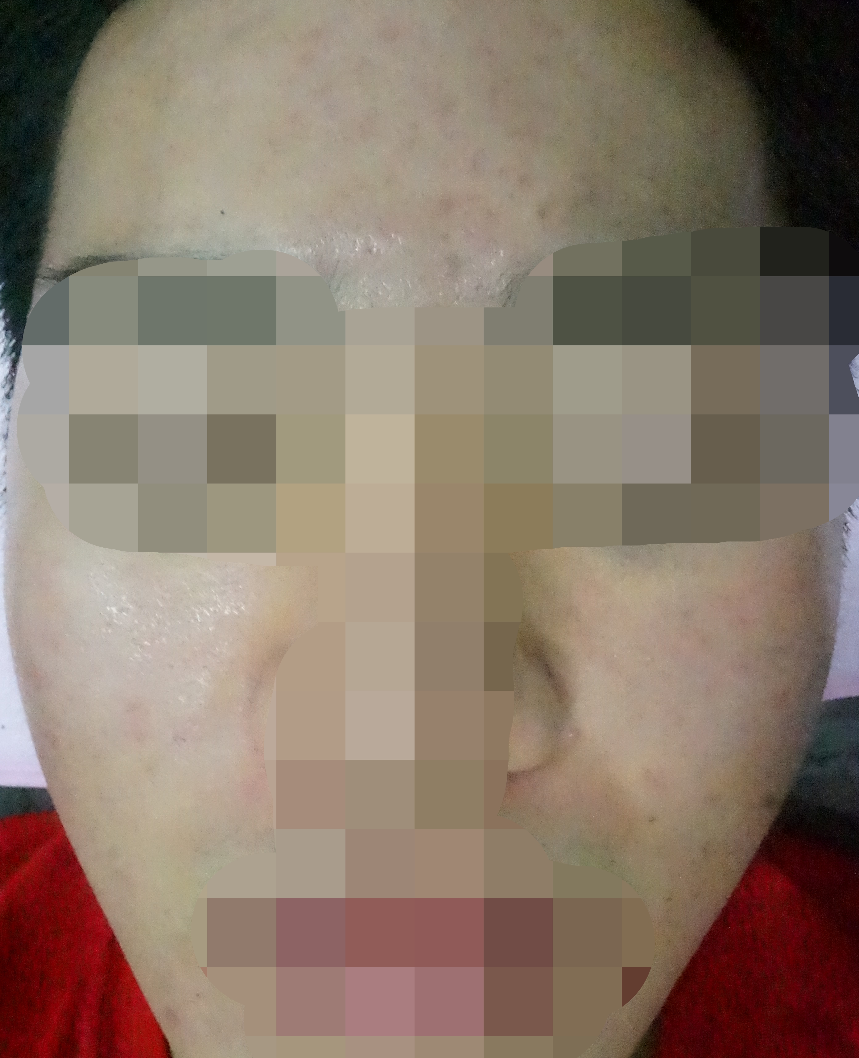 전후사진