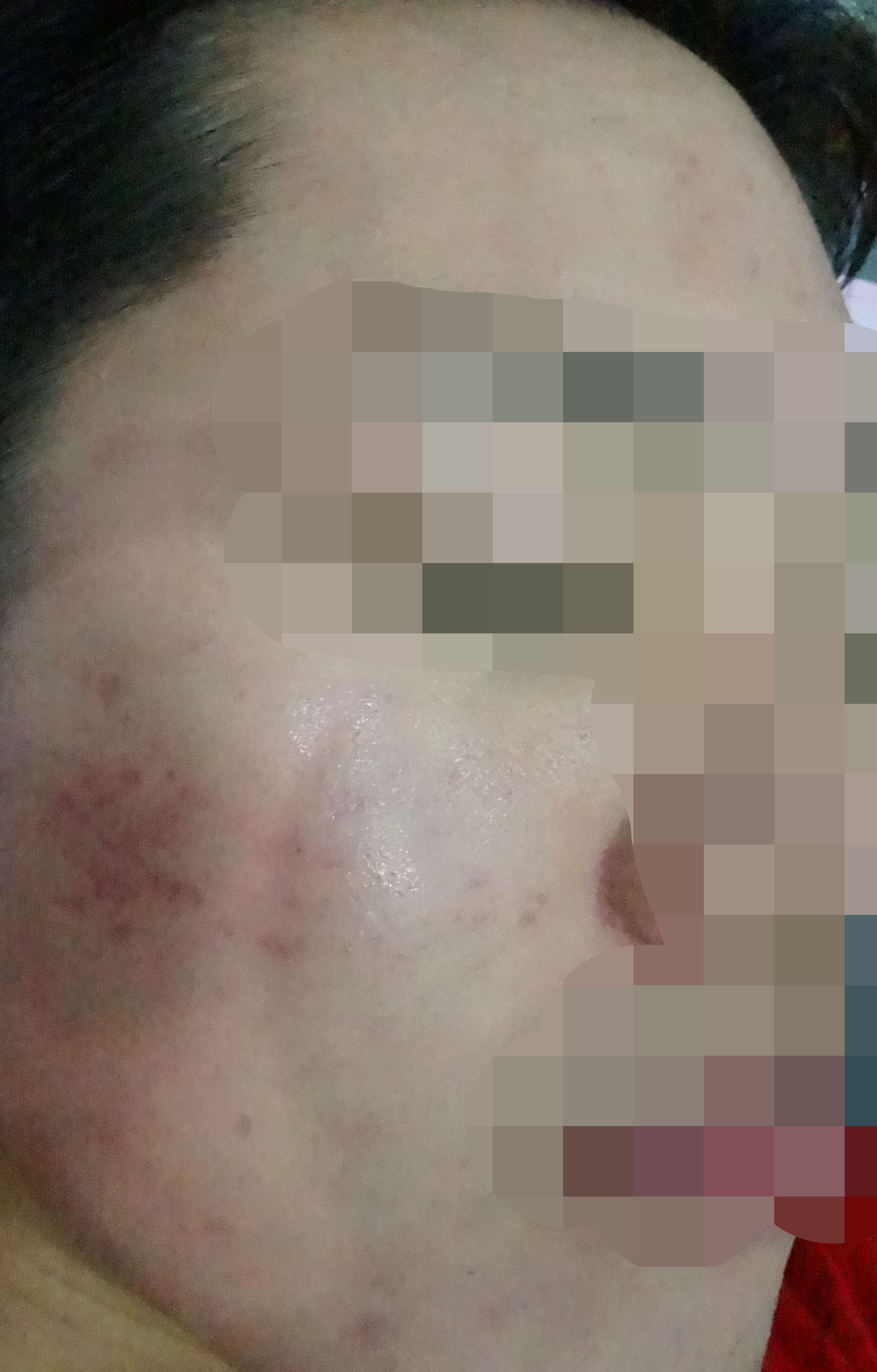 전후사진