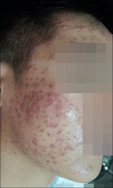 전후사진