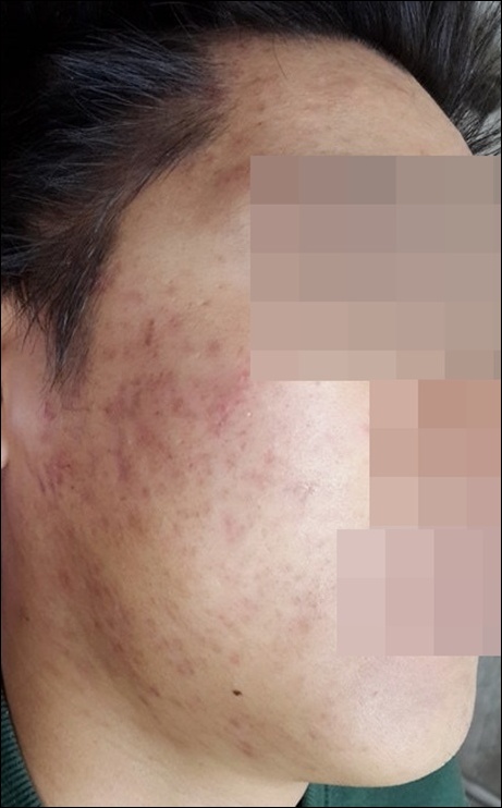 전후사진