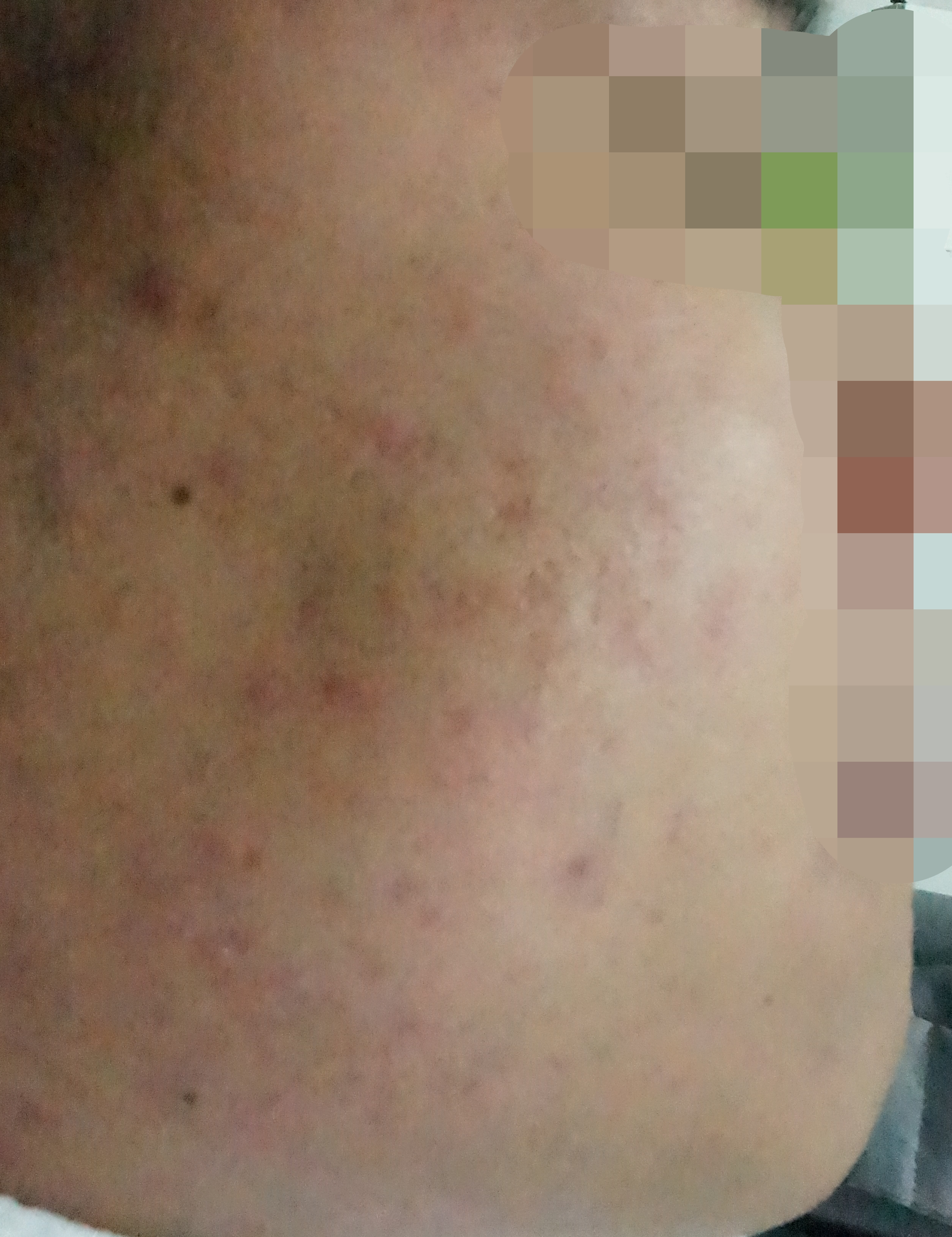 전후사진