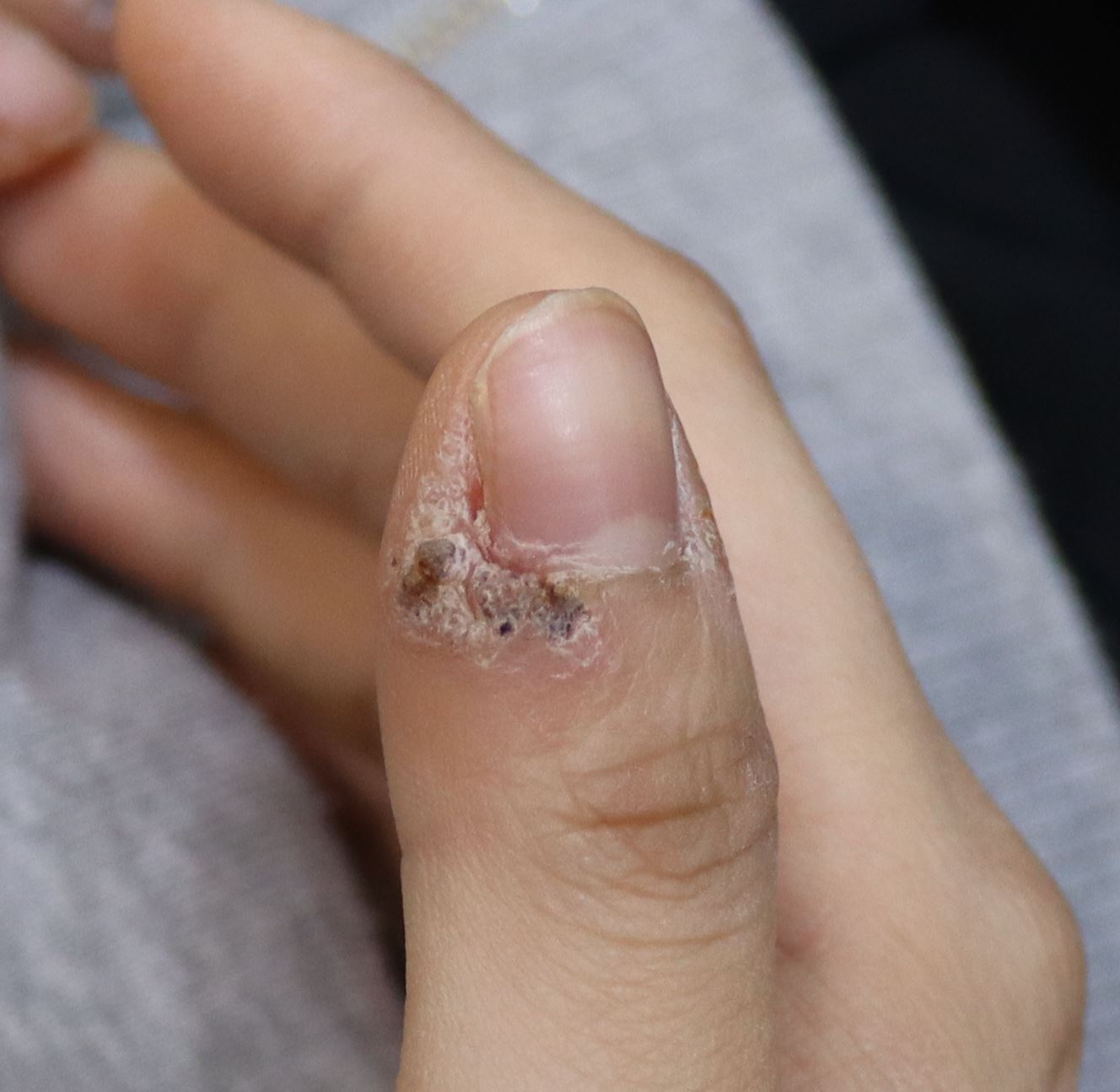 전후사진