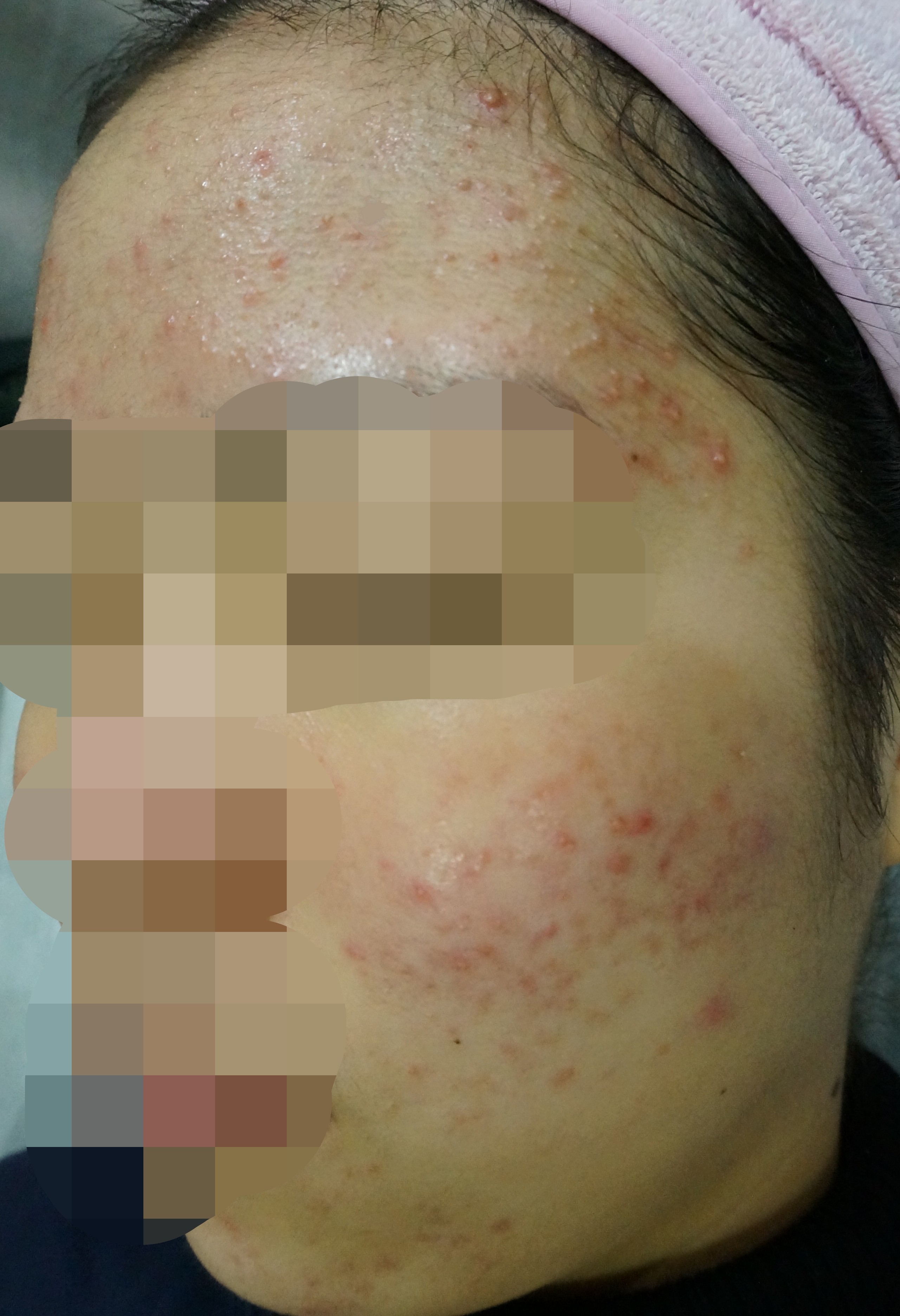 전후사진
