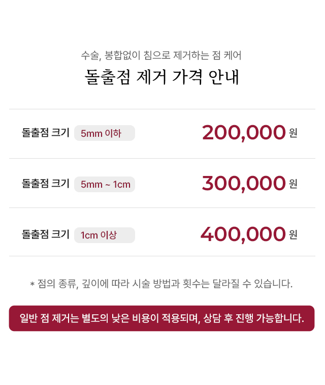 점 제거